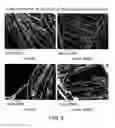 Fig. 04 - Hemostatic textile