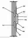 Fig. 01 - Shape and pressure adjustable dressing
