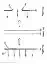 Fig. 02 - Shape and pressure adjustable dressing