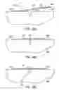 Fig. 13 - Shape and pressure adjustable dressing