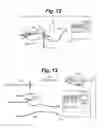 Fig. 06 - METHOD AND SYSTEM FOR TREATING TISSUE SWELLING