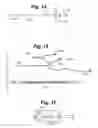 Fig. 07 - METHOD AND SYSTEM FOR TREATING TISSUE SWELLING