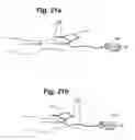 Fig. 10 - METHOD AND SYSTEM FOR TREATING TISSUE SWELLING