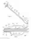 Fig. 02 - Multi-conduit balloon catheter