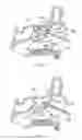 Fig. 11 - Multi-conduit balloon catheter