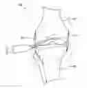 Fig. 01 - Implantable device for production of interleukin-1 receptor antagonist
