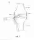Fig. 04 - Implantable device for production of interleukin-1 receptor antagonist