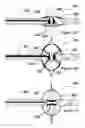 Fig. 08 - Methods for inhibiting renal nerve activity