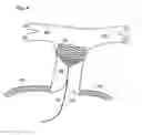 Fig. 05 - GUIDEWIRE WITH ANCHOR