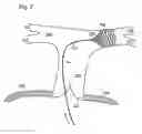 Fig. 08 - GUIDEWIRE WITH ANCHOR