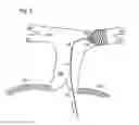 Fig. 09 - GUIDEWIRE WITH ANCHOR