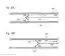 Fig. 12 - GUIDEWIRE WITH ANCHOR