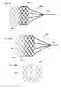 Fig. 20 - GUIDEWIRE WITH ANCHOR
