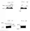 Fig. 03 - Side-deployed medical guidewire torquer