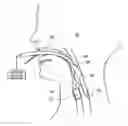 Fig. 01 - VACUUM ASSIST DEVICE TO REMOVE OBJECT FROM TRACHEA