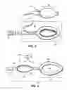 Fig. 03 - VACUUM ASSIST DEVICE TO REMOVE OBJECT FROM TRACHEA