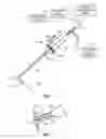 Fig. 02 - Laparoscopic Laser Device and Method