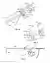Fig. 04 - Laparoscopic Laser Device and Method
