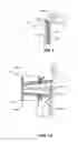 Fig. 05 - Laparoscopic Laser Device and Method