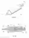 Fig. 04 - Electrosurgical tissue treatment method