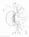 Fig. 16 - Electrosurgical tissue treatment method