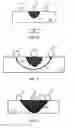 Fig. 05 - Multipolarity epicardial radiofrequency ablation