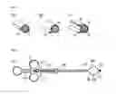 Fig. 04 - Monopolar RF-surgical snares