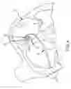 Fig. 06 - System and method for treating arrhythmias in the heart using information obtained from heart wall motion