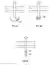 Fig. 10 - METHODS AND DEVICES FOR TREATING TISSUE