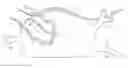 Fig. 01 - Pair of endocardial and epicardial catheters, catheter and method for positioning electrodes on a cardiac wall and method for the ablation of cardiac muscle tissue