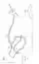 Fig. 02 - Pair of endocardial and epicardial catheters, catheter and method for positioning electrodes on a cardiac wall and method for the ablation of cardiac muscle tissue