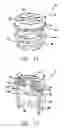 Fig. 08 - Method and device for ameliorating joint conditions and diseases