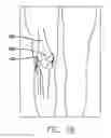 Fig. 09 - Method and device for ameliorating joint conditions and diseases