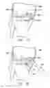 Fig. 10 - Method and device for ameliorating joint conditions and diseases