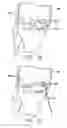Fig. 11 - Method and device for ameliorating joint conditions and diseases