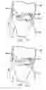 Fig. 12 - Method and device for ameliorating joint conditions and diseases
