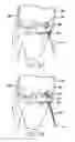 Fig. 13 - Method and device for ameliorating joint conditions and diseases