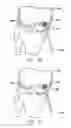 Fig. 17 - Method and device for ameliorating joint conditions and diseases