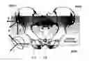 Fig. 01 - Methods and devices for patient-specific acetabular component alignment in total hip arthroplasty