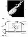 Fig. 03 - Methods and devices for patient-specific acetabular component alignment in total hip arthroplasty