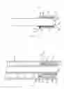 Fig. 02 - Proximal Release Expandable Prosthesis Delivery System