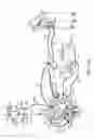 Fig. 03 - Hysteroscopic tissue removal system with improved fluid management and/or monitoring capabilities