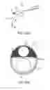 Fig. 04 - Hysteroscopic tissue removal system with improved fluid management and/or monitoring capabilities