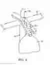 Fig. 06 - Hysteroscopic tissue removal system with improved fluid management and/or monitoring capabilities