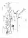 Fig. 02 - Tissue removal system