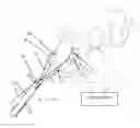 Fig. 01 - Birth delivery device with position sensor