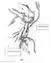 Fig. 03 - Birth delivery device with position sensor