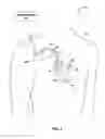 Fig. 03 - Implantable medical device fixation