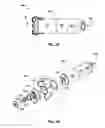 Fig. 04 - Implantable medical device fixation