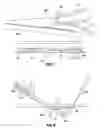 Fig. 05 - LAPAROSCOPIC DEVICE INSERTION CANNULA